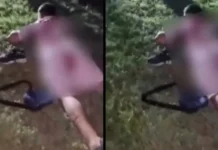 14-year-old boy stabbed seven times and beaten unconscious in Skopje’s Chento